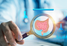 Colonoscopy Prep: What Patients Should Know